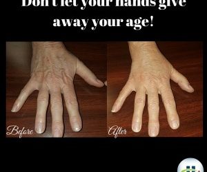 5 Tips To Turn Back The Clock for Aging Hands