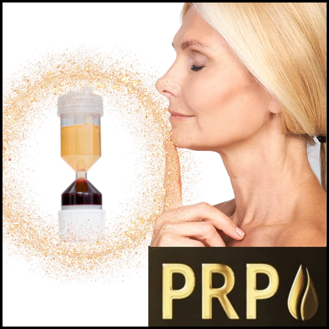 PRP gold